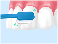 ブラッシング指導