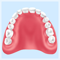 レジン床入れ歯【保険診療】