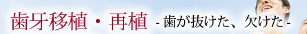 歯牙移植・再植 -歯が抜けた、欠けた-